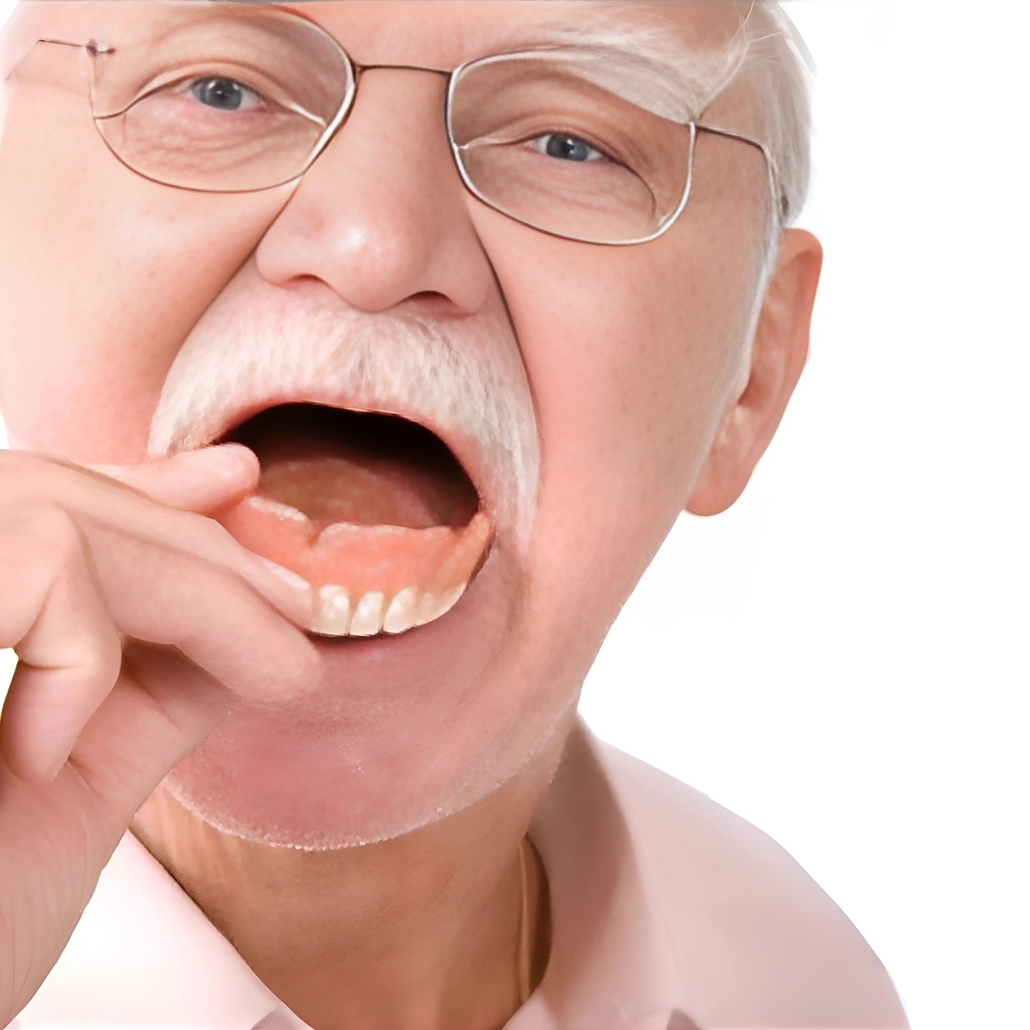Full Denture Set - Perfect, Confident Smile